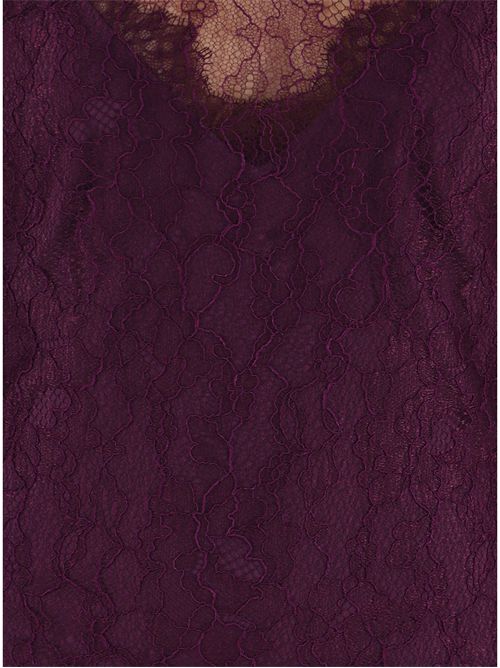  TWINSET | TT2261/12635